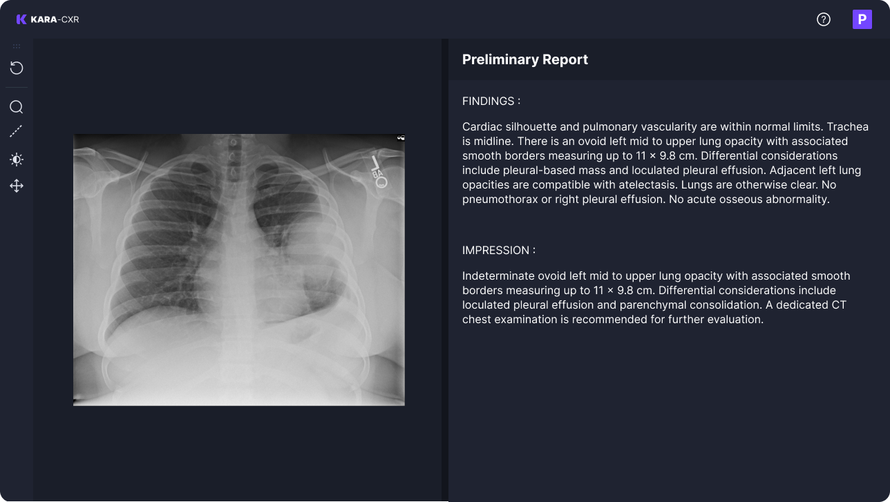 Example Report Generator